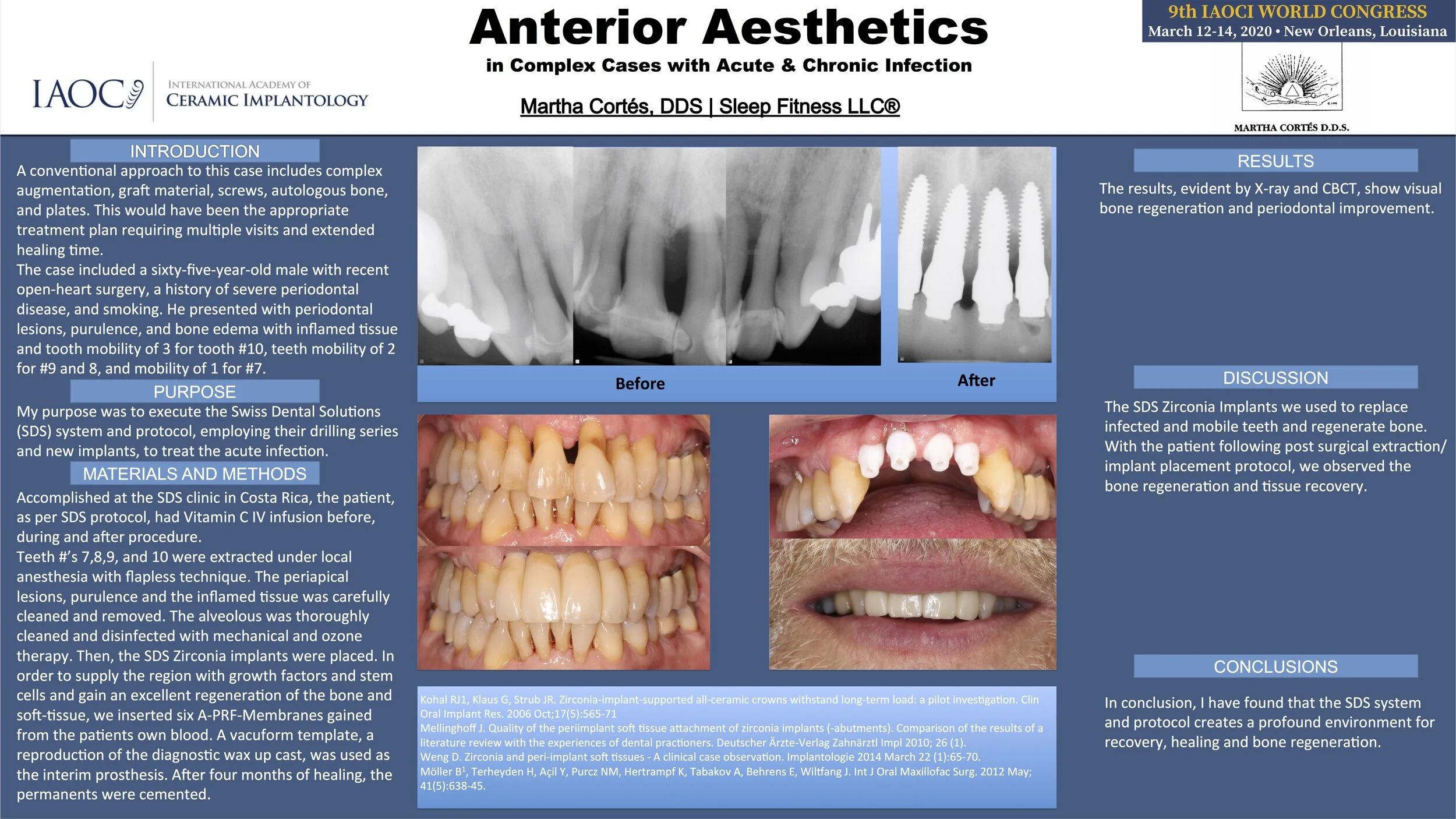 Implant Cases — Martha Cortés, DDS